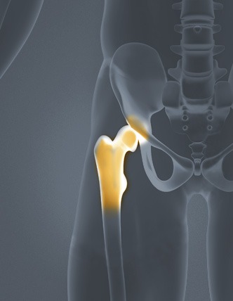 Hip Pain Diagram